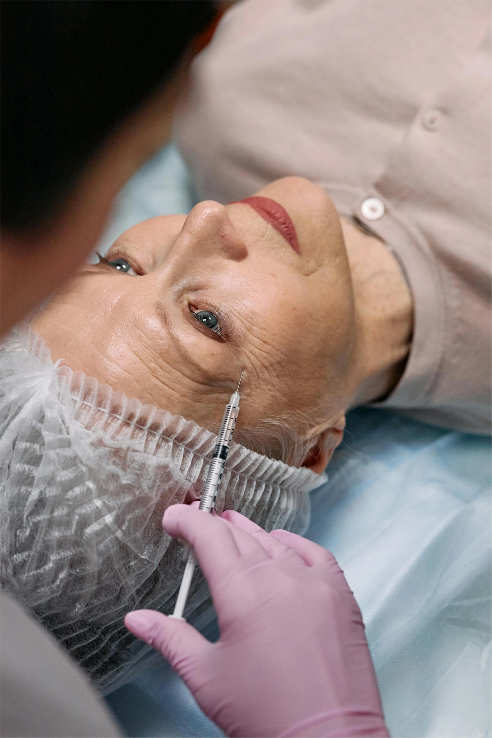 anti-wrinkle-treatments