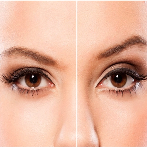 eye brow lift