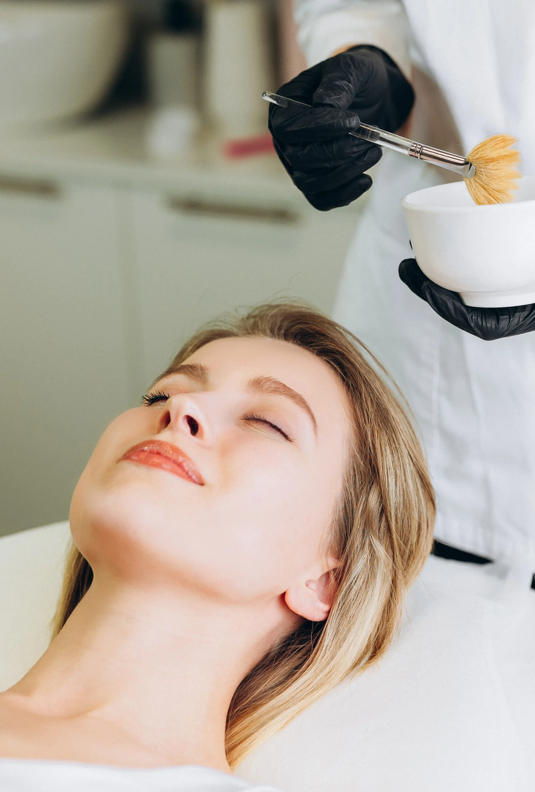 skin peels